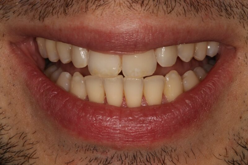 After - Cheadle Hulme Dental