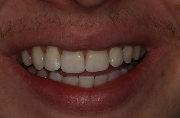 After - Cheadle Hulme Dental
