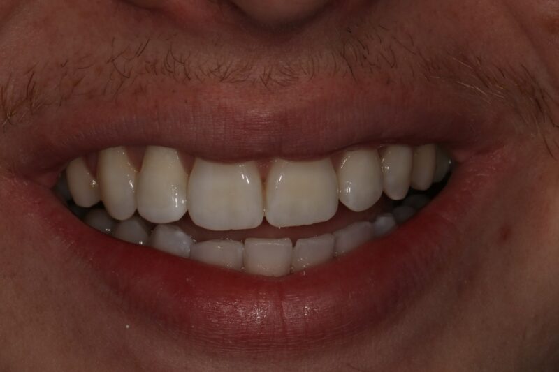 After - Cheadle Hulme Dental