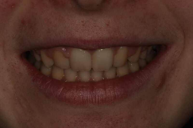 After - Cheadle Hulme Dental