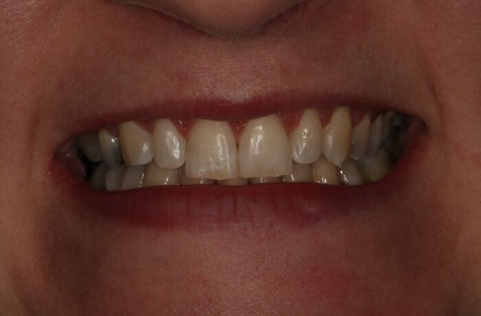 After - Cheadle Hulme Dental