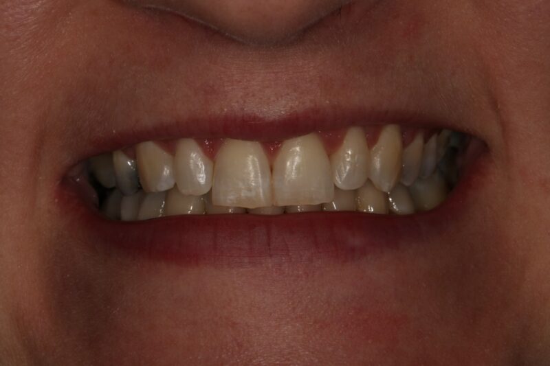 After - Cheadle Hulme Dental