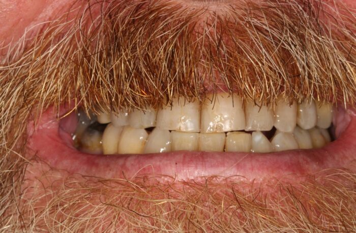 After - Cheadle Hulme Dental