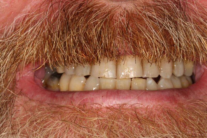 After - Cheadle Hulme Dental