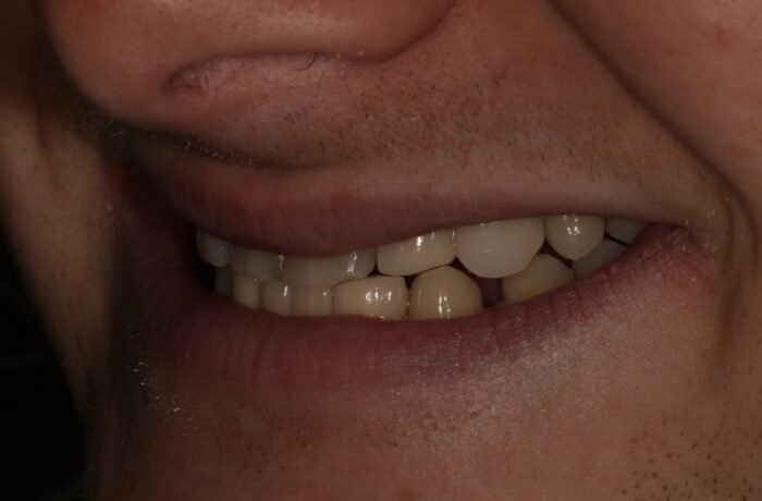 After - Cheadle Hulme Dental