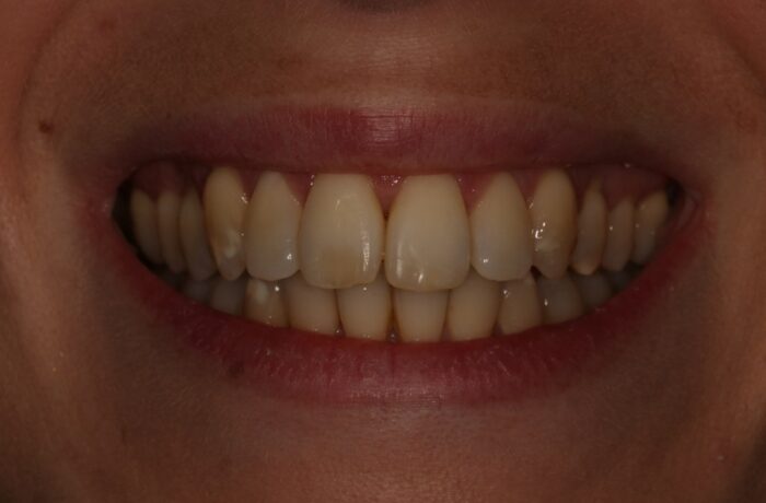After - Cheadle Hulme Dental