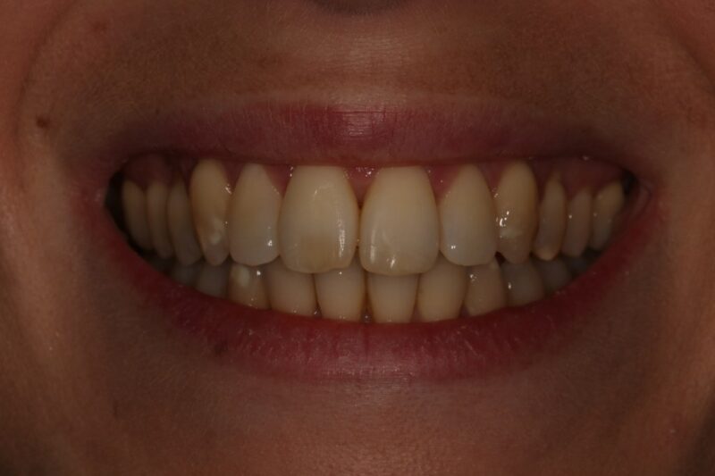 After - Cheadle Hulme Dental