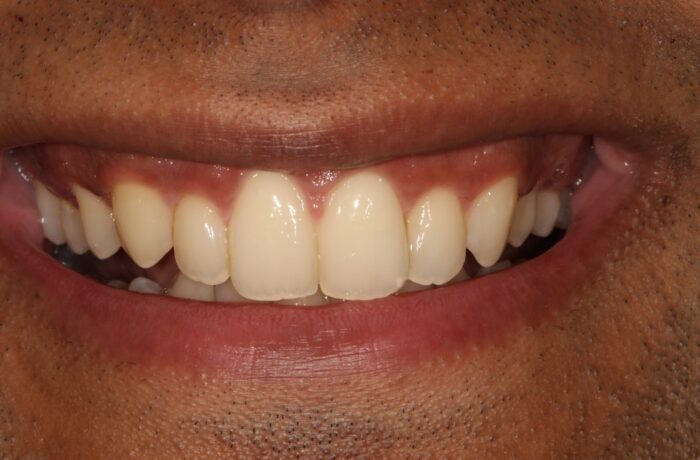 After - Cheadle Hulme Dental