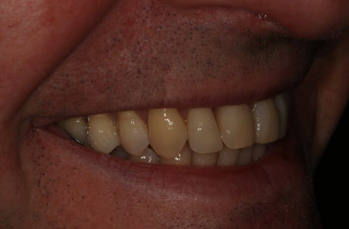 After - Cheadle Hulme Dental