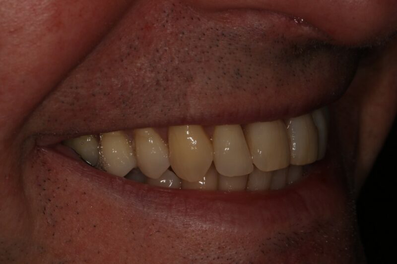 After - Cheadle Hulme Dental