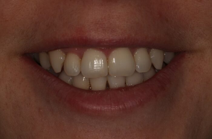 After - Cheadle Hulme Dental
