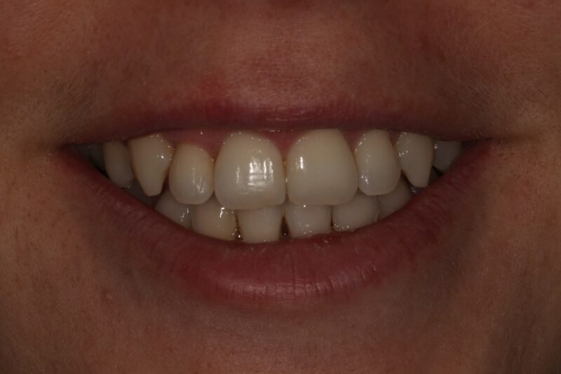 After - Cheadle Hulme Dental