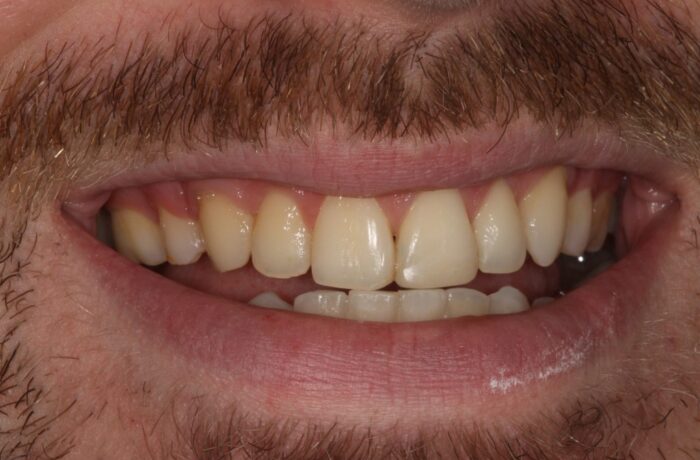 After - Cheadle Hulme Dental