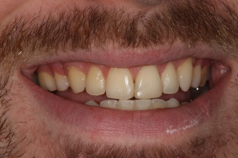 After - Cheadle Hulme Dental