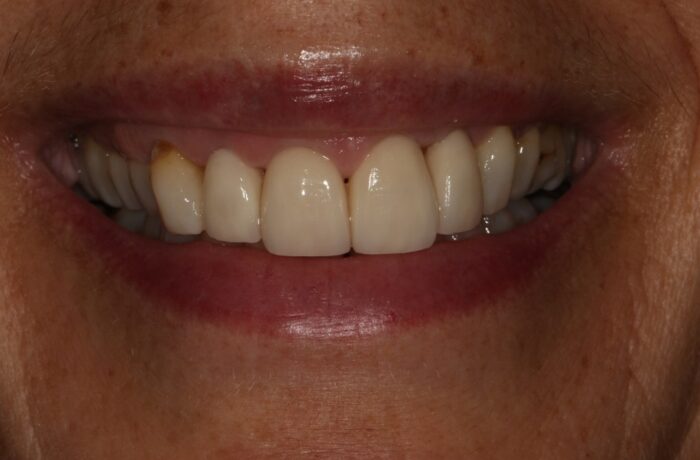 After - Cheadle Hulme Dental