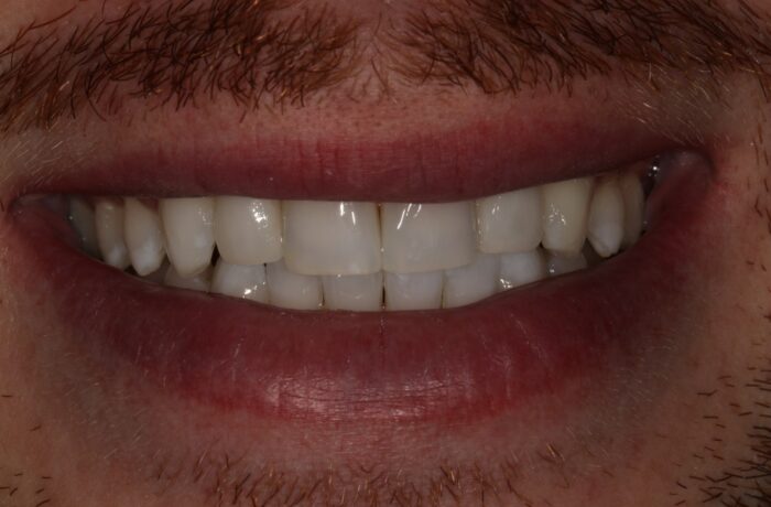 After - Cheadle Hulme Dental