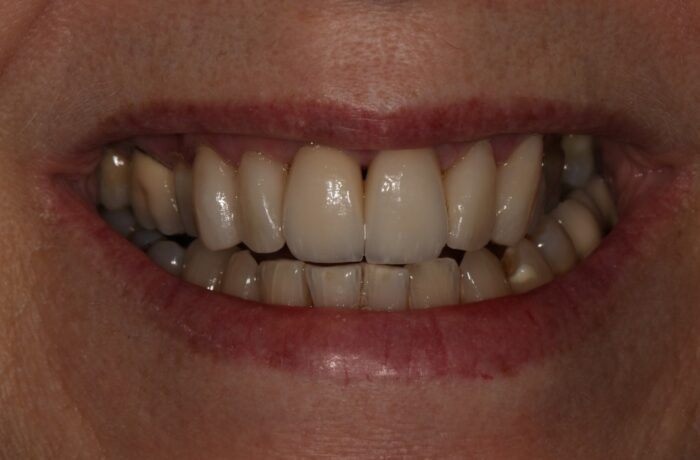 After - Cheadle Hulme Dental