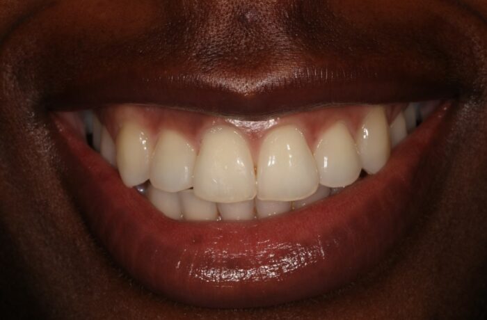 After - Cheadle Hulme Dental
