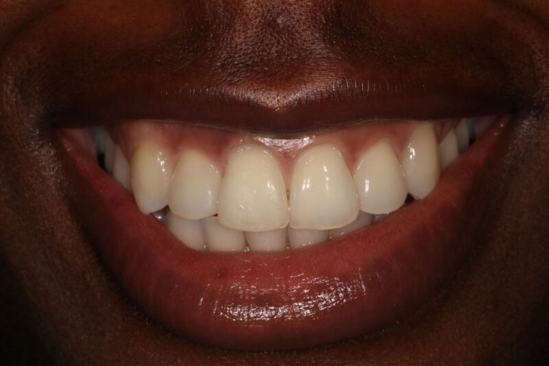 After - Cheadle Hulme Dental