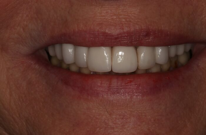 After - Cheadle Hulme Dental