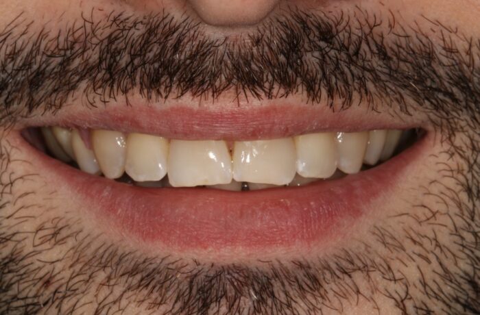 After - Cheadle Hulme Dental