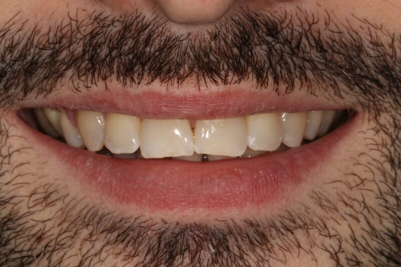 After - Cheadle Hulme Dental