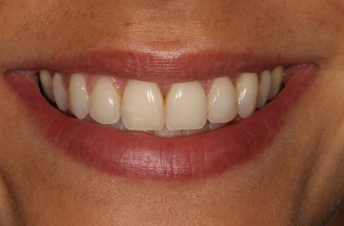 After - Cheadle Hulme Dental
