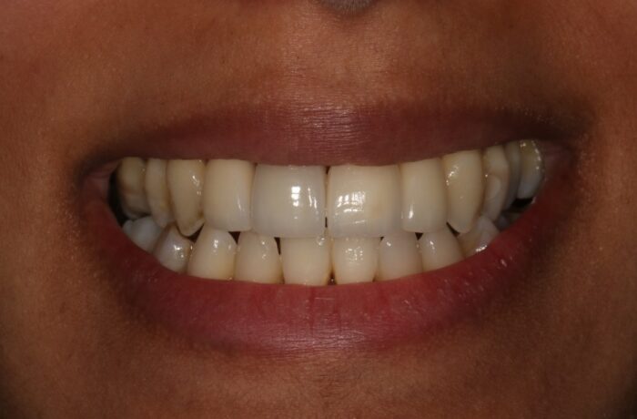 After - Cheadle Hulme Dental
