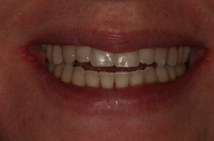After - Cheadle Hulme Dental