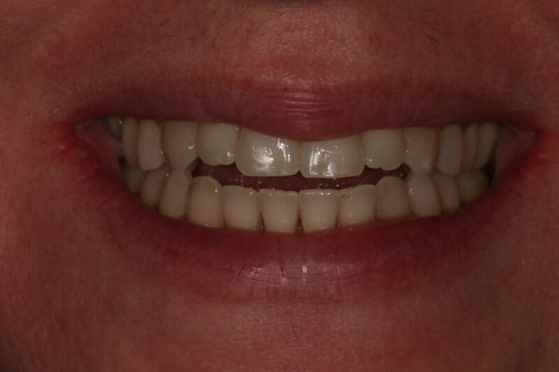 After - Cheadle Hulme Dental