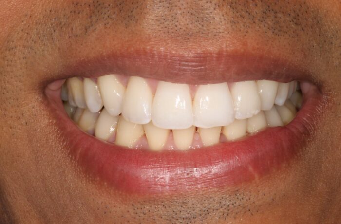 After - Cheadle Hulme Dental