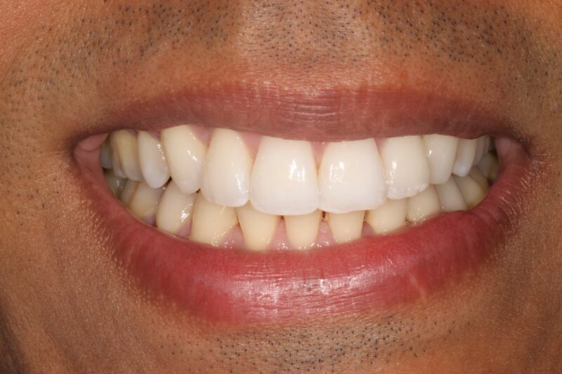 After - Cheadle Hulme Dental