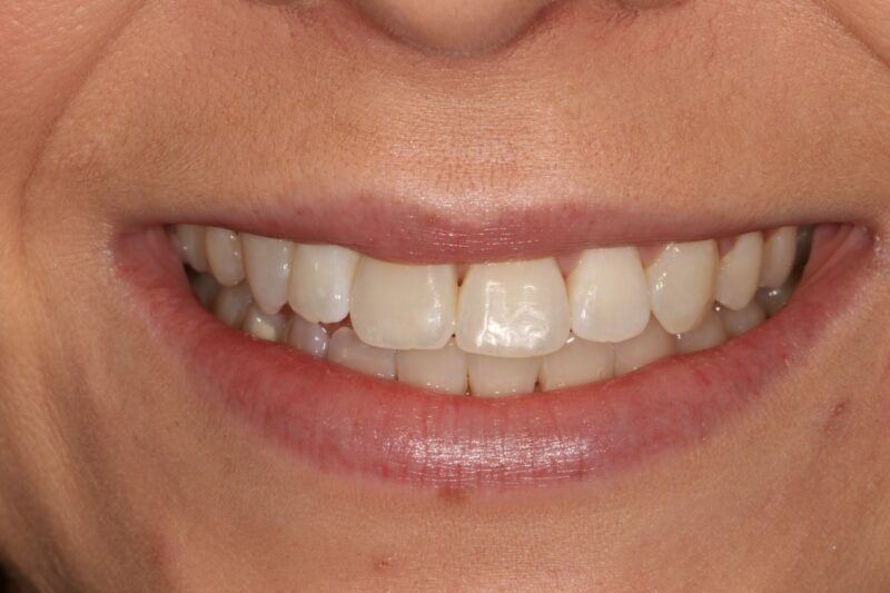 After - Cheadle Hulme Dental