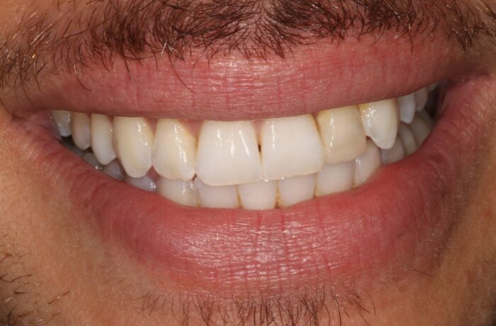 After - Cheadle Hulme Dental