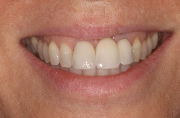 After - Cheadle Hulme Dental
