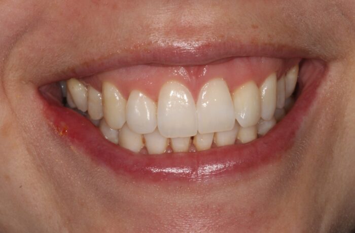 After - Cheadle Hulme Dental