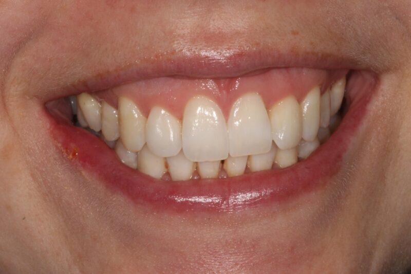 After - Cheadle Hulme Dental
