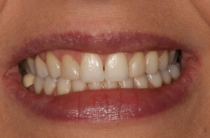 After - Cheadle Hulme Dental