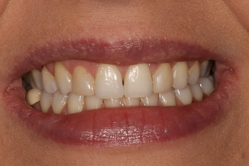 After - Cheadle Hulme Dental