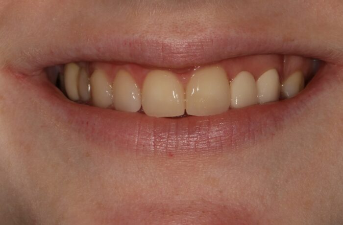 After - Cheadle Hulme Dental
