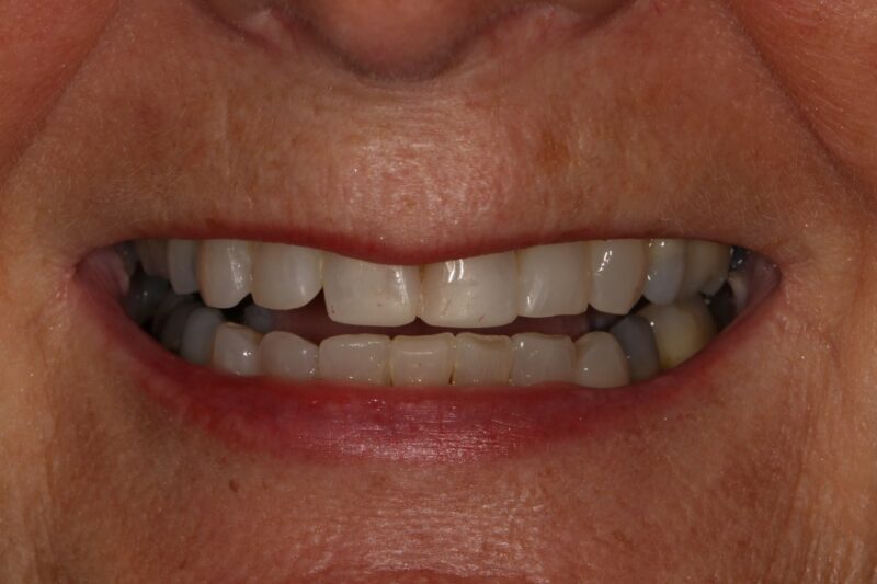 After - Cheadle Hulme Dental