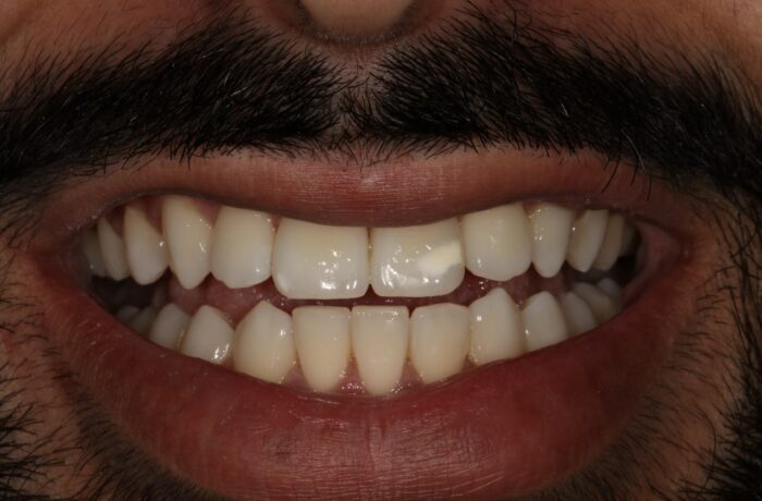After - Cheadle Hulme Dental