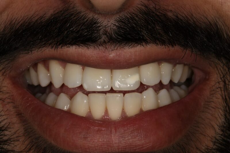 After - Cheadle Hulme Dental