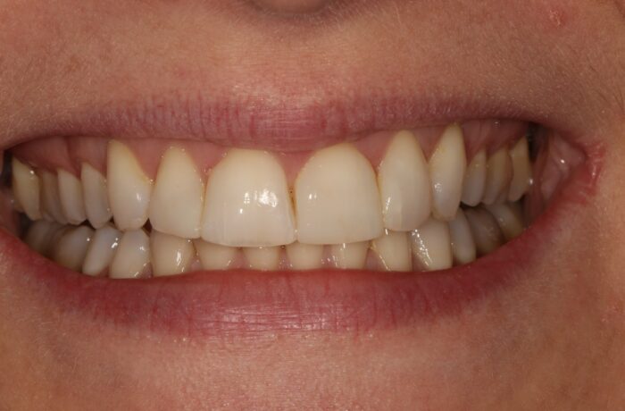 After - Cheadle Hulme Dental