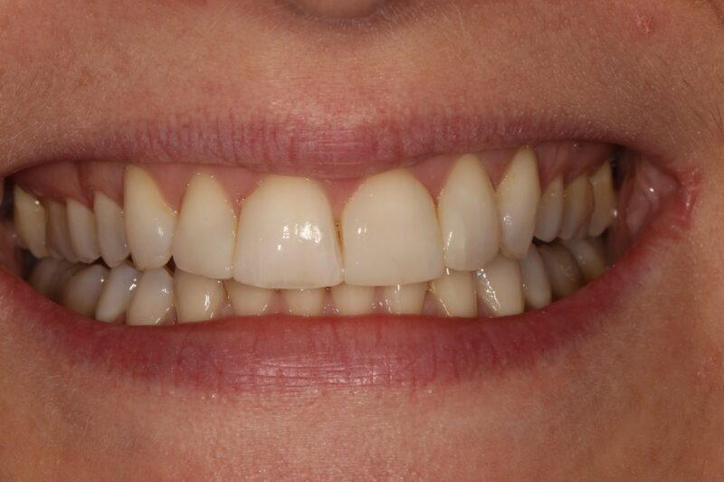 After - Cheadle Hulme Dental