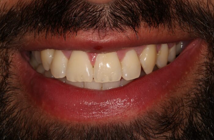 After - Cheadle Hulme Dental