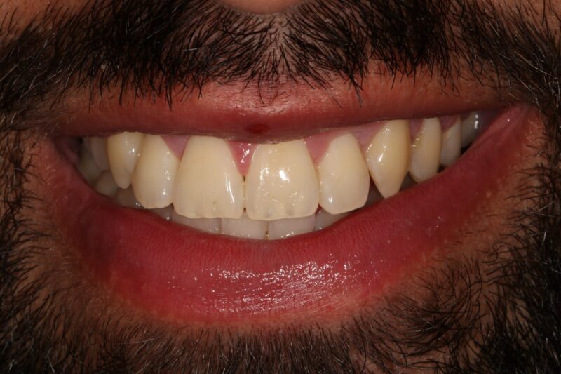 After - Cheadle Hulme Dental