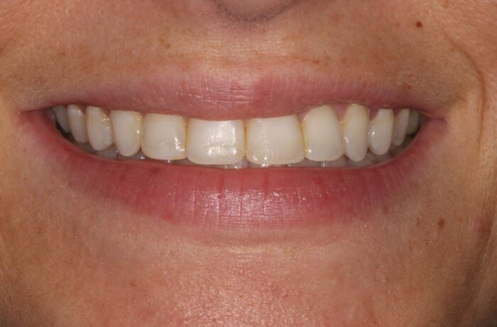 After - Cheadle Hulme Dental