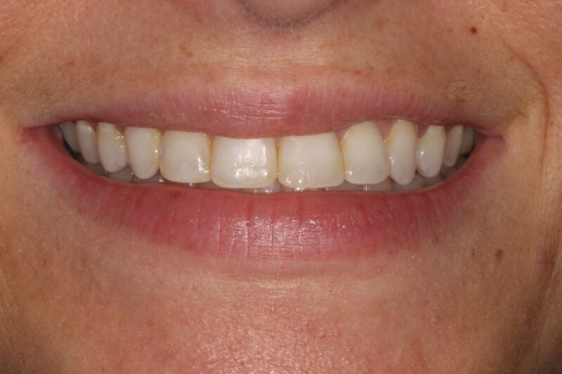 After - Cheadle Hulme Dental