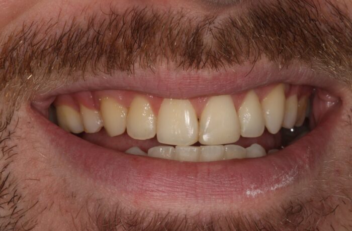 After - Cheadle Hulme Dental